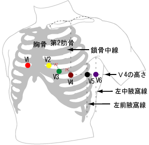 ecg_style_chest_position.png